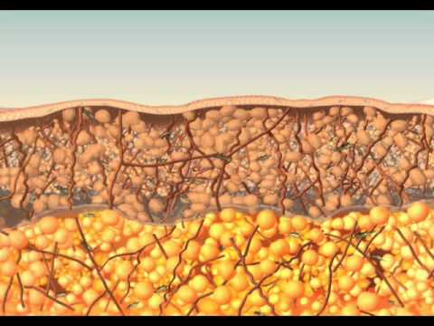 TriPollar Skin Tightening