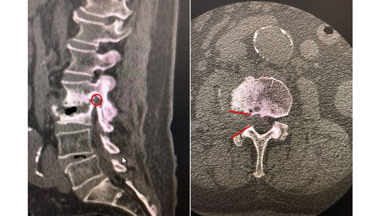 Marcelo Botelho Soares De Brito-19