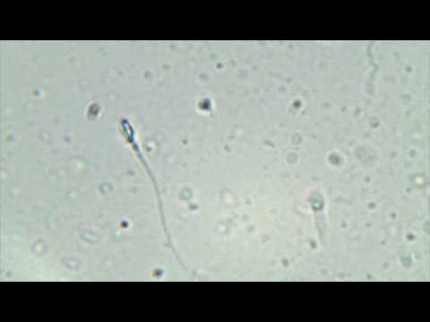 my sperm dancing to d.a.n.c.e by Justice under a microscope