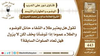 صورة 5598 -هل يعتبر طلاء الشفاء حائل للوضوء ؟ - نور على الدرب