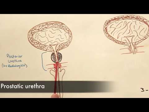 Prostatitis treatment guidelines idsa