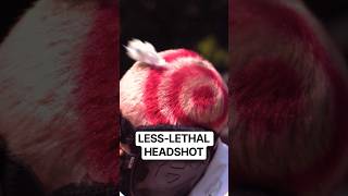 I Got Shot in the Head… #shorts #funny #science