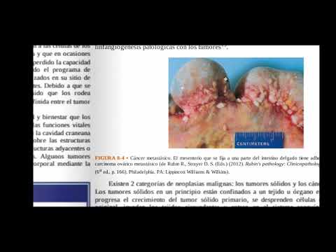 Neoplasias benignas y malignas CAP 8 PARTE 2