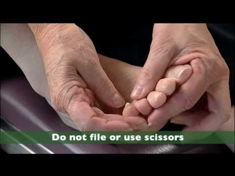 How to Examine Your Feet (for people with diabetes)