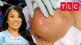 All the Pops from Seasons 1-4! | Dr. Pimple Popper | TLC
