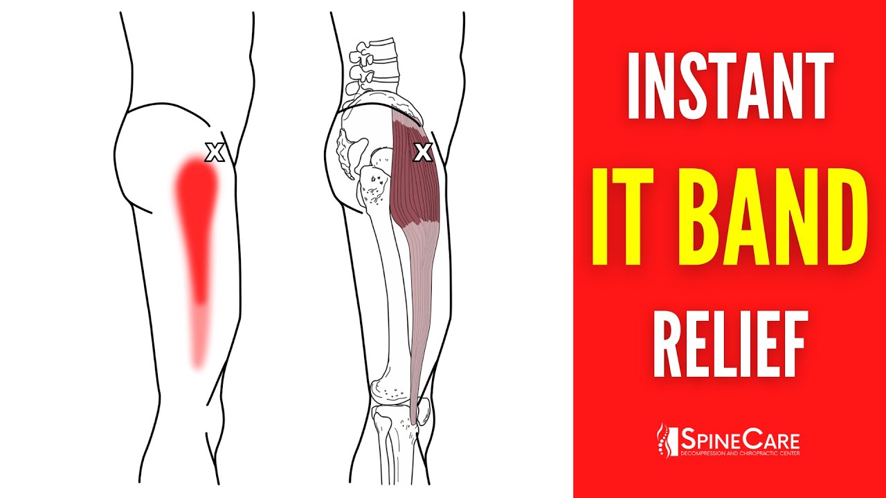 How to Relieve Iliotibial Band Pain FOR GOOD