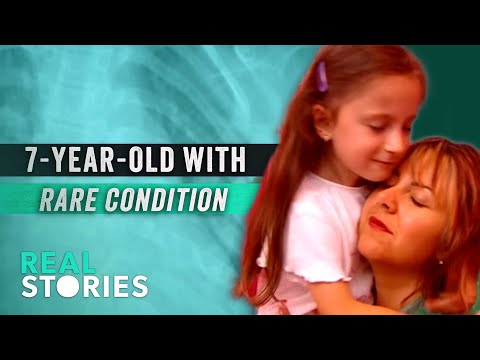 7 Year-Old's Muscles Turn to Bone: How Luciana Overcame FOP (Rare Disease Documentary)