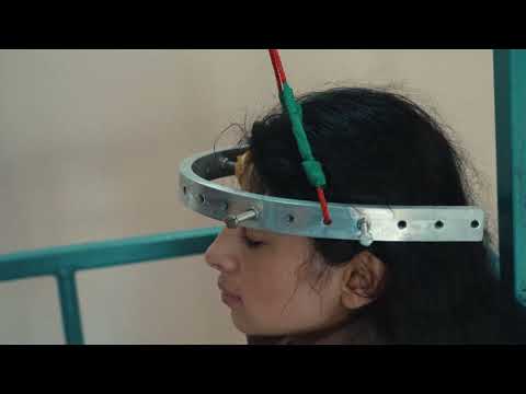 ID 487. Maftuna. Yigirma yillik kurash va hayotni davom ettirish imkonini bergan murakkab operatsiya