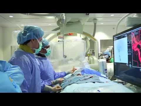 Nance's Story: Treating a Cerebral Aneurysm