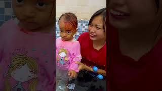 Download lagu #SHORTS | BAYI LUCU BERDARAH KENA LATO LATO 😭 mp3 Download lagu #SHORTS | BAYI LUCU BERDARAH KENA LATO LATO 😭 mp3