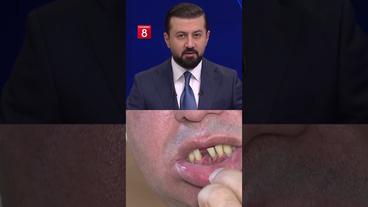 ڤیدیۆ | چیرۆکی ئەو کارمەندە سکیوریتییەی دوای شەش ڕۆژ لە ئەشکەنجەدان لەلایەن ئاسایشی هەولێرەوە و شاربەدەر کرا