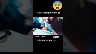 Ladki ki NEck par😨 pimple / cyst / Movie explained in hindi / #viral #shorts #shortsfeed