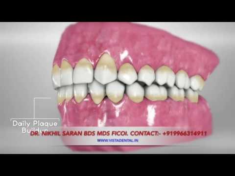 How to brush your teeth.