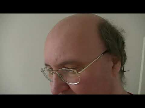 MongoTV_7355 - KIGGER PÅ EL LØBEHJUL - Del 6 - Min Vægt Er Tæt På 125 Kilo