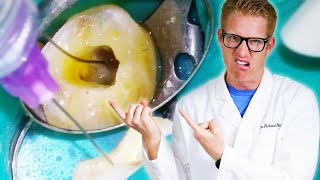 Dentist Explains Every TOOTH PAIN AFTER ROOT CANAL TREATMENT? Throbbing Relief Months or Years Later