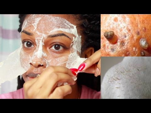 EASY DIY Egg Blackhead Remover Peel Off Mask