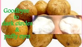 Potato for dark circle & puffy eyes under eyes ||simple home remedy for dark circles & puffy eyes||