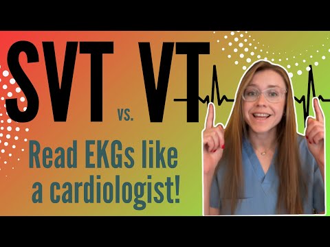 VT vs SVT with Aberrancy Explained Clearly!