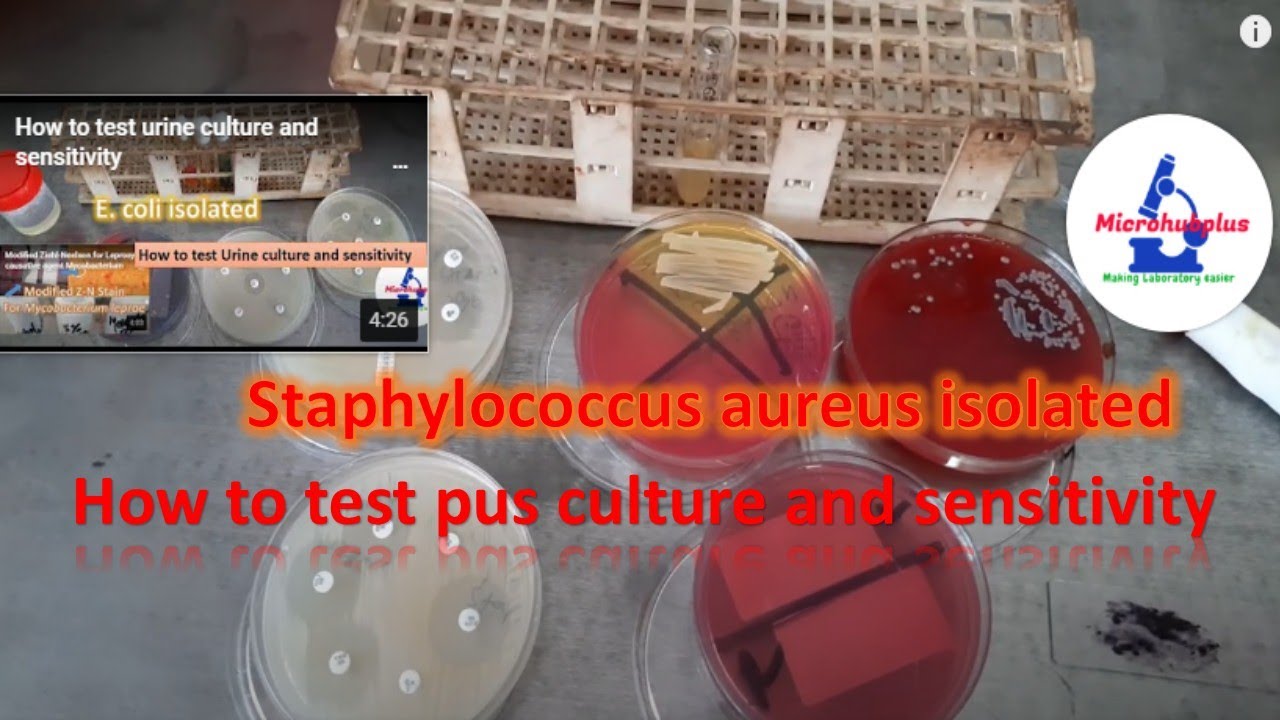 How to test  pus culture and sensitivity
