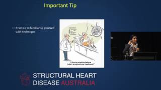 Left atrial size and function – Prof Liza Thomas