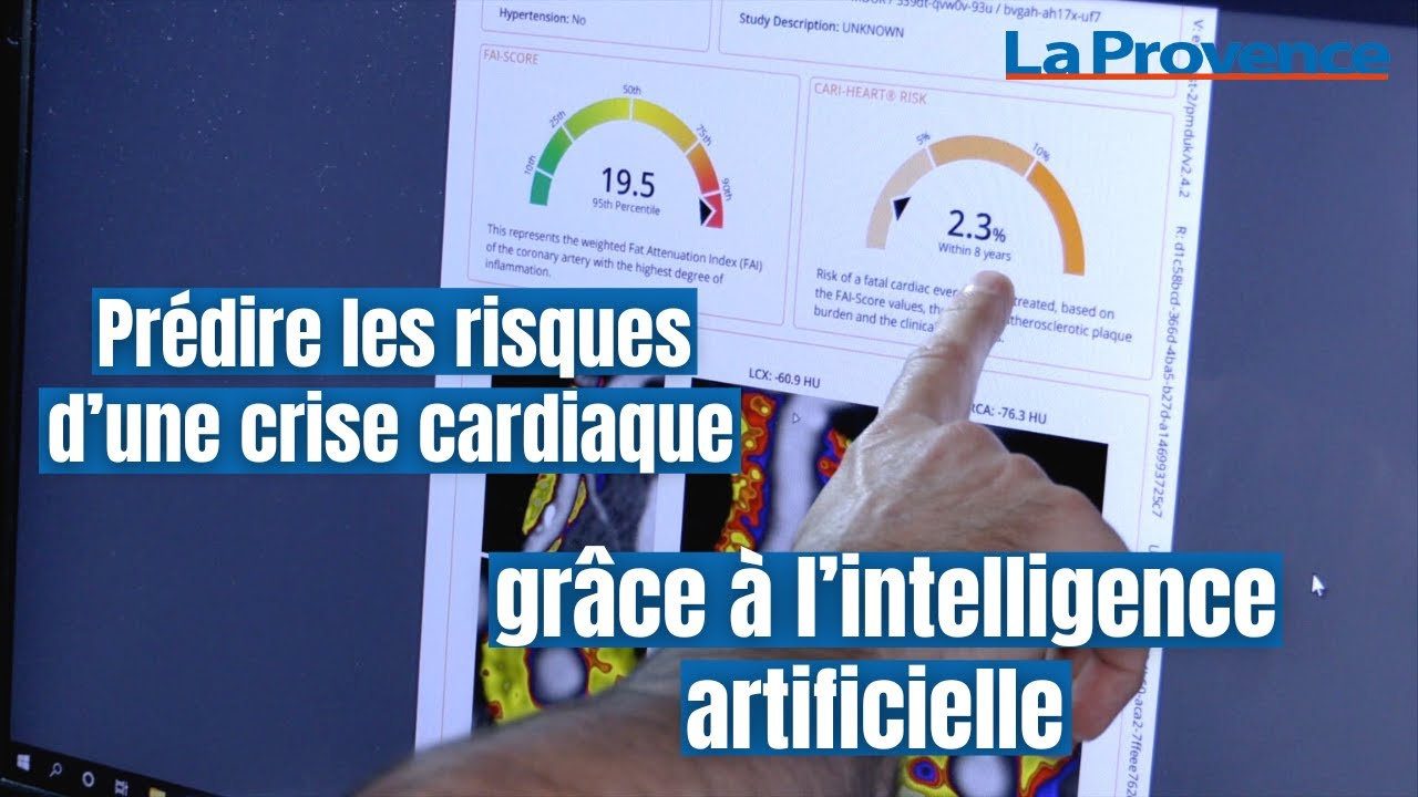 Aix : prédire les risques d’une crise cardiaque grâce à l’intelligence artificielle