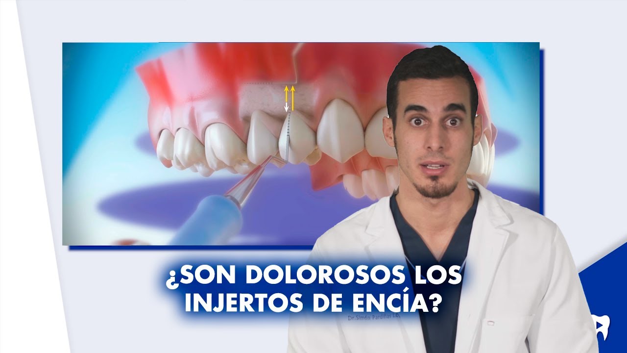 Watch ¿Es doloroso el INJERTO DE ENCÍA ¿Puede fracasar | #Shorts Now ¿Es doloroso el INJERTO DE ENCÍA ¿Puede fracasar | #Shorts