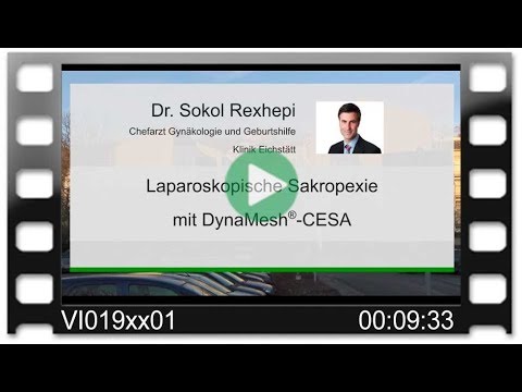 DynaMesh®-CESA OP-Video: CESA OP Technik - Cervico-Sakropexie - Laparoskopie