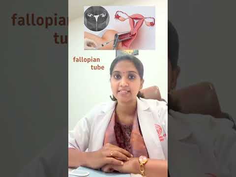 IUI Treatment Explained | Procedure, Success Rate & Who Should Avoid IUI | Dr. Deepeka T S 