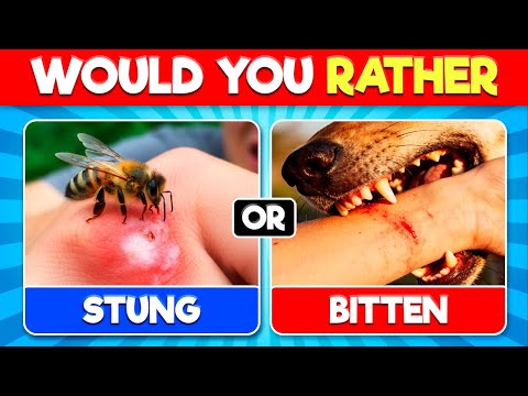 Would You Rather...? Most Extreme Choices Ever 😱 !!