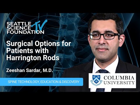 Surgical Options for Patients with Harrington Rods – Zeeshan Sardar, M.D.