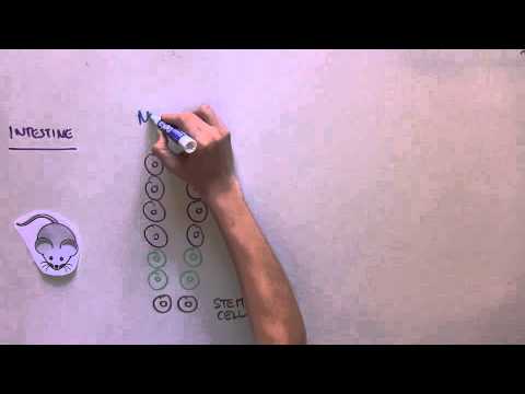 BRANDING CANCER STEM CELLS: Discovery of a hot new intestinal cancer stem cell marker!