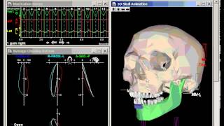 Normal Skull View on Jaw Tracker