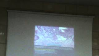 32) Dr.Wael Shawky 23-2-2016 [Mucoepidermoid Carcinoma till Complications of Peptic Ulcer]