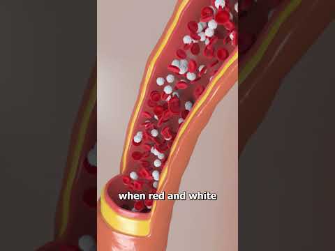 Why You See Floating Dots In The Sky 🤔