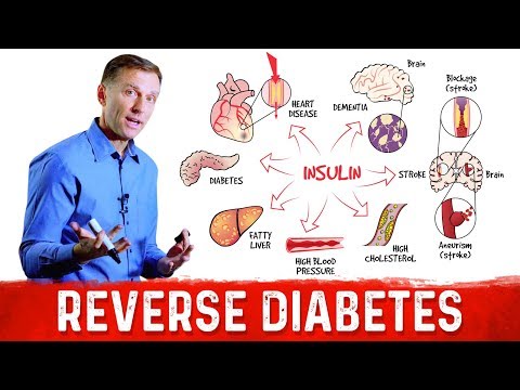 How to Reverse Damage from Diabetes?  – Dr.Berg on Reversing Diabetes