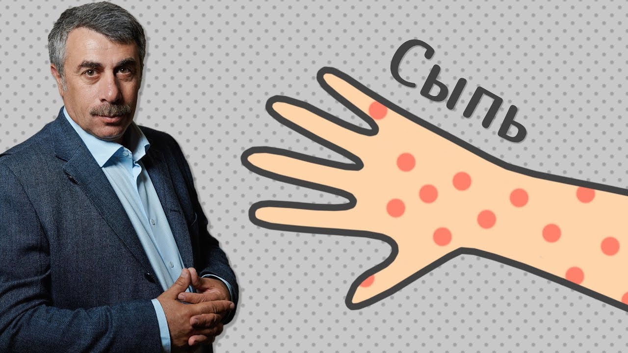 Сыпь - Доктор Комаровский