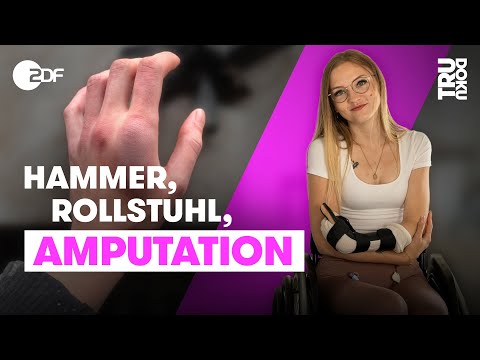 Kimberly (25) will mit Prothese zurück auf den Bau | TRU DOKU