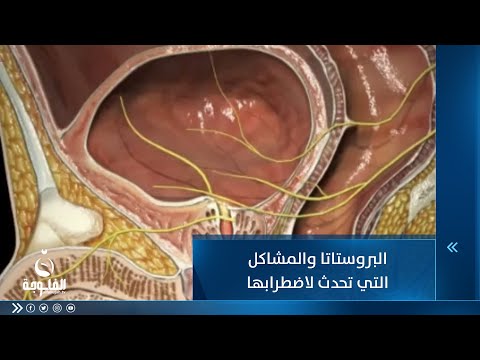 شاهد بالفيديو.. ما هي البروستاتا وما المشاكل التي تحدث لاضطرابها؟ |  تقرير: أمجد الكبيسي