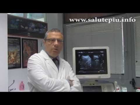 Prostatite nelle donne e il suo trattamento Massaggio medico della prostata massaggiatrice