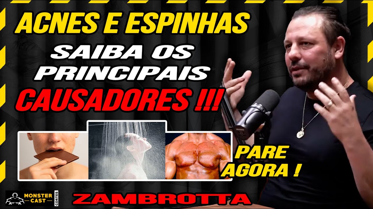 O FATORES QUE MAIS CAUSAM ACNE E ESPINHAS EM 90% DAS PESSOAS ! ZAMBROTTA