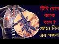 টিবি রোগ কি What Is TB Disease In Bangla