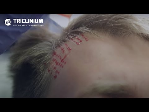 Włos nie spadnie krótkie i długie Lekarz lekarz w Arzamas