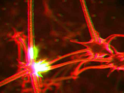 Metric - Gold Guns Girls (NiT GriT & Stephan Jacobs Remix) VJ Mix