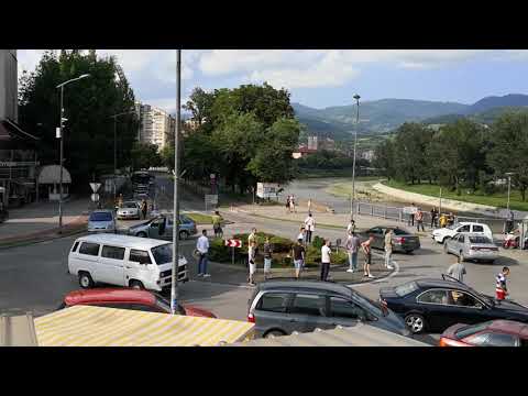 Koślawego ostatni etap Przed masażem koślawego