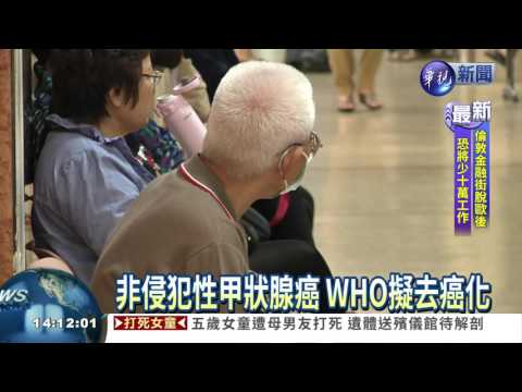 非侵犯性甲狀腺癌 研擬去癌化