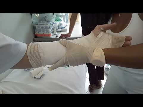 download lagu mp3 mp4 Gesso Ortopedico, download lagu Gesso Ortopedico gratis, unduh video klip Gesso Ortopedico