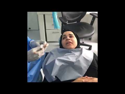 Video On The Wisdom Tooth Removal Surgery