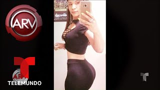 Víctimas de CIRUGÍAS PLÁSTICAS mal hechas revelan su drama | Al Rojo Vivo