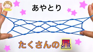 あやとり 6段はしご の作り方 簡単 分かりやすい 音声解説あり ばぁばのあやとり أفضل موقع لتشغيل ملفات Mp3 مجان ا あやとり 6段はしご の作り方 簡単 分かりやすい 音声解説あり ばぁばのあやとり أفضل موقع لتشغيل ملفات Mp3 مجان ا
