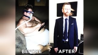 Dad Is Unrecognizable After Excess Skin Is Removed From 300-Pound Weight Loss